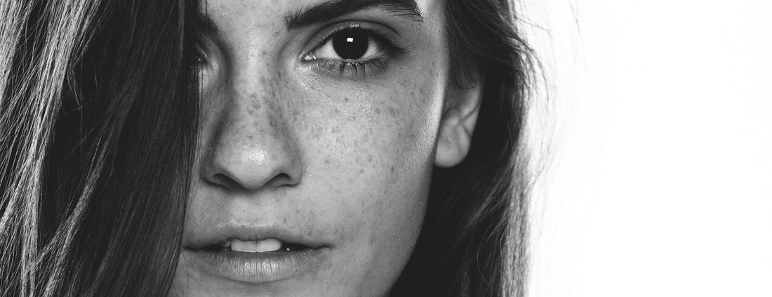 How to Get Rid of Dark Spots