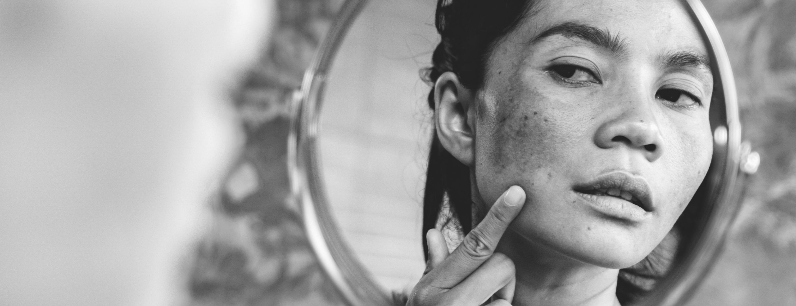 4 Signs of Aging Caused by Sun Damage