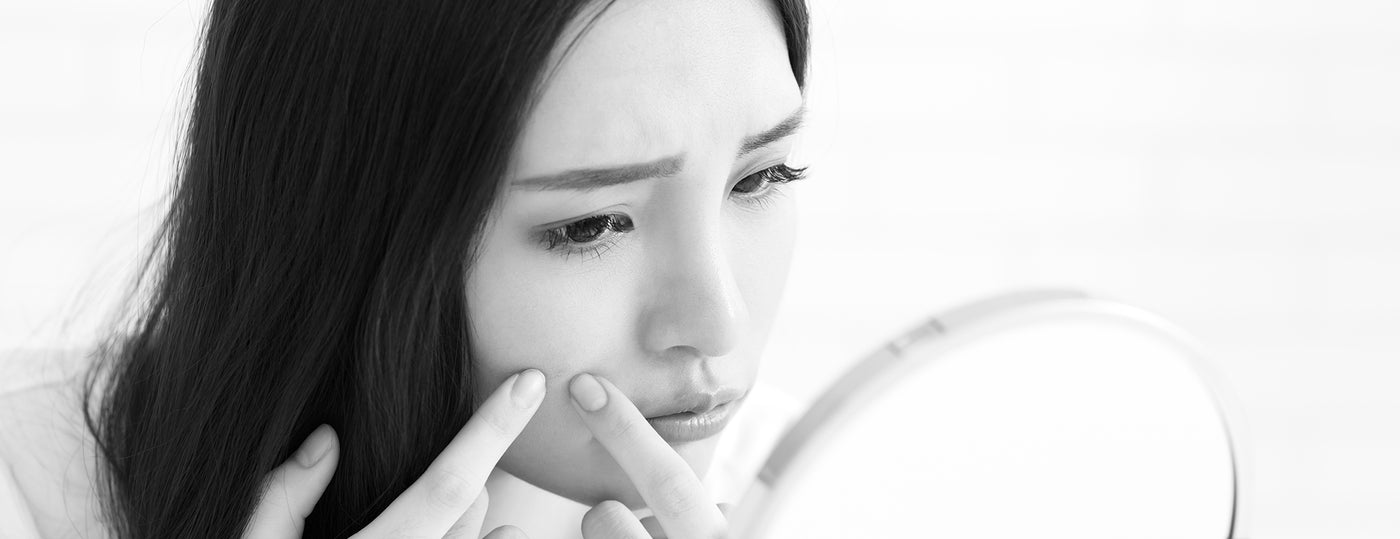 How to Reduce Redness of Acne and Inflammation, Pain-Free