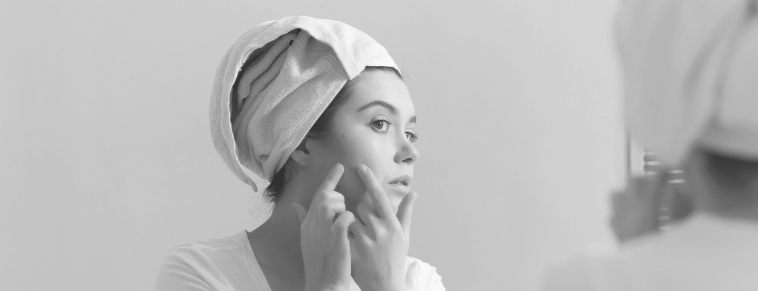 How to Fight Acne